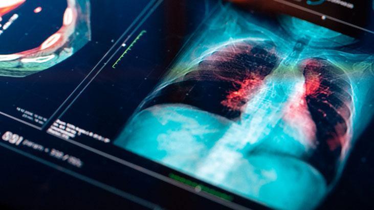 haber-gorseli-1788176043309